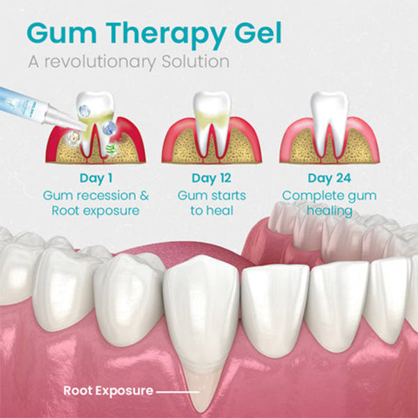 🔥Last Day Promotion 80% OFF-NESLEMY™ Gum Shield Therapy Gel